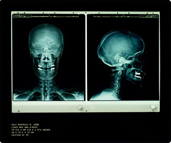 Damien Hirst, Self-Portrait (X-Ray) at Morgan O'Driscoll Art Auctions